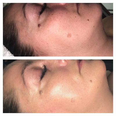 Dermaplaning with makeup add on