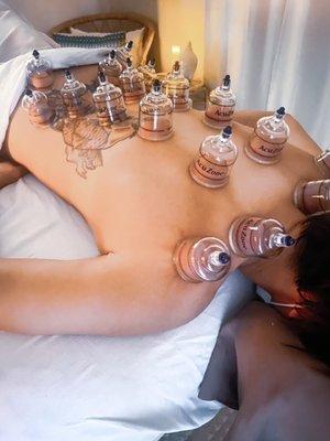 Cupping therapy