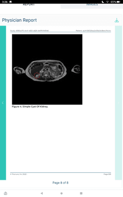 Small simple right renal cyst.