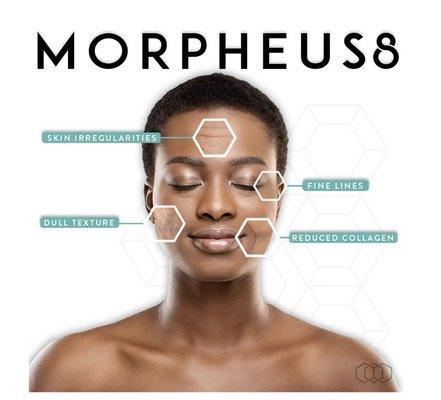 Microneedling with radiofrequency. Improve texture, tone and increase collagen with Morpheus8 at Jade!