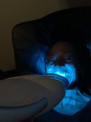 Teeth Whitening