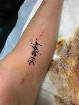 10 stitches