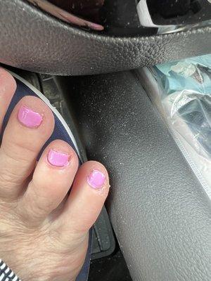 Poorly done pedicure.