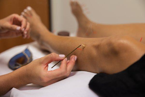 Life Point Acupuncture