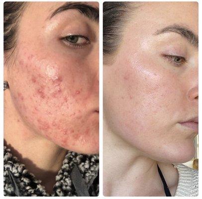 Client skin transformation!