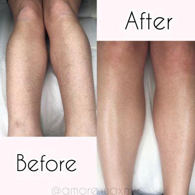 Lower Leg Wax With Hard Wax