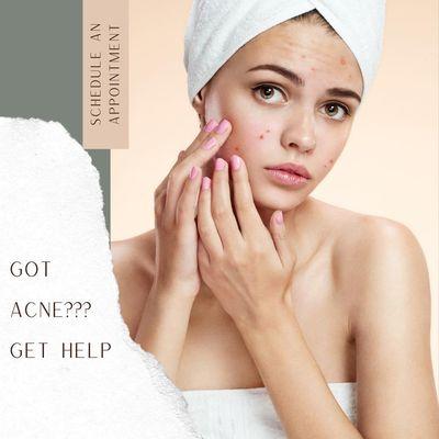 Book Isolaz Acne Treatment