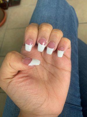 Uneven and messed up nails