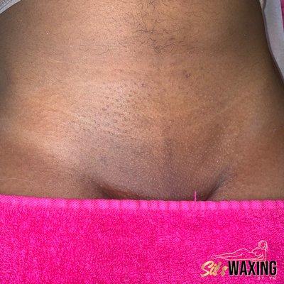 Brazilian wax results