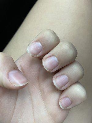 Cuticle care