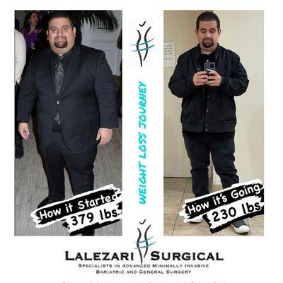 Lost 147lbs with bariatric surgery