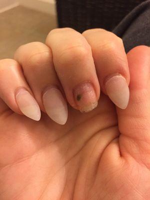 The green spot under my nail I described in my review.