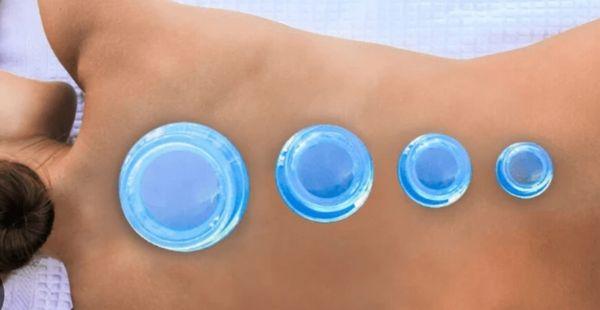 Cupping works by decompression of the affected area to release the tissues and promotes blood flow