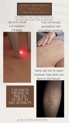 Spider Vein removal