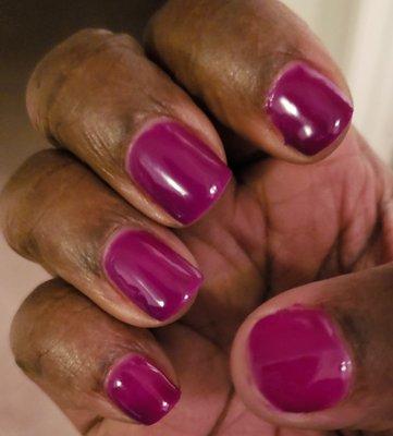 Shellac polish UV cured to skin