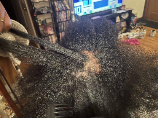 My daughter had very healthy 4C hair and no scalp issues. After going to Nikki, this is the damage.