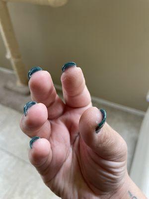 Terrible nail job.