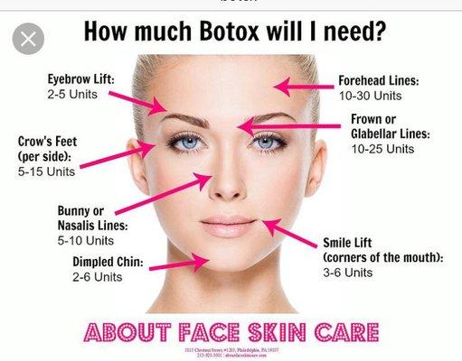 Botox $12 per unit