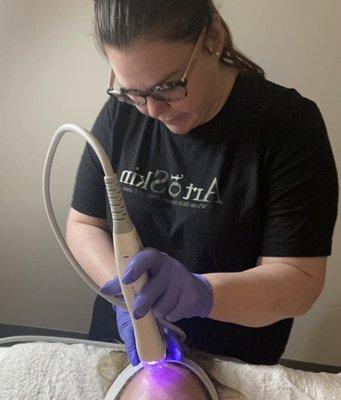 Painless microneedle treatment!