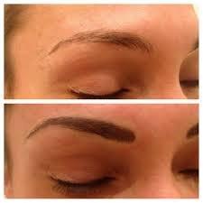 Before and after Brows