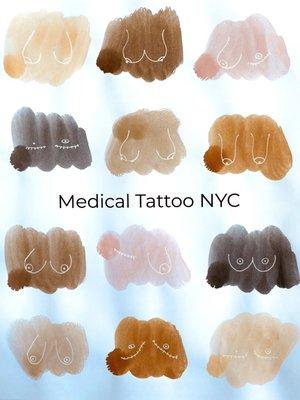 Medical Tattoo NYC