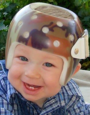 Zack sporting his camo cranial remolding helmet