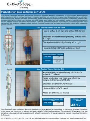 We thrive on improving efficiency and eliminating pain through movement. Static posture. Walking/running gait & dynamic movement patterns