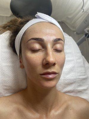 Microdermabrasion + microcurrent