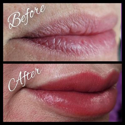 Lip Blush add fullness and definition to the mouth, as well as correct an uneven lip line. It can even minimize the appearance of wrinkles.