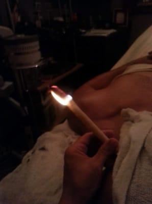 Ear candling