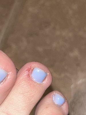 cut on my toe