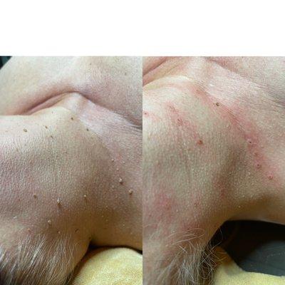 Hebe skin management