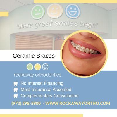 Rockaway Orthodontics provides Ceramic Braces