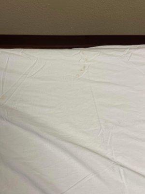 Yellow and brown stains on "clean" linen