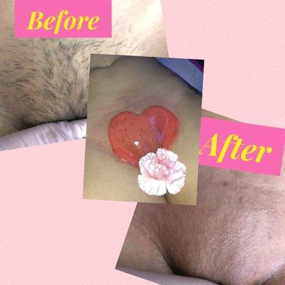 Vajacial with Brazilian Wax