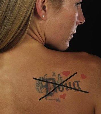 Northshore Tattoo Removal Covington, LA