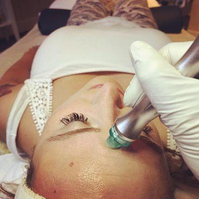 Hydrodermabrasion Oxygen Infusion Facial Treatment