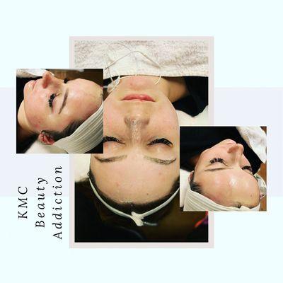 Facial