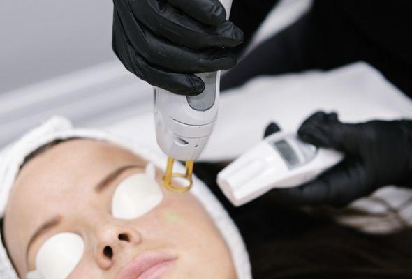 Laser Resurfacing Facial