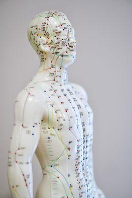 Acupuncture Meridian Treatments.  Great for sciatica, chronic pain, digestive complaints, and hot flashes