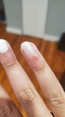 My inflamed cuticles