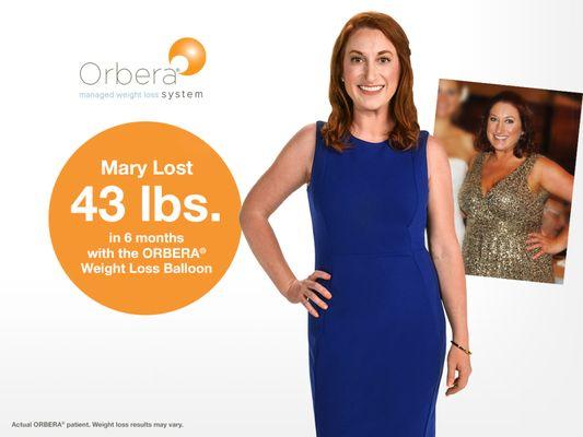 NEW at NuBody Concepts: The Orbera Gastric Ballon. Finally, a weight loss program that works, without surgery!