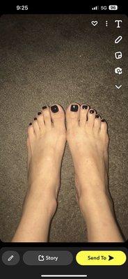 Previous visits with other lady's where my toe nail is not crooked