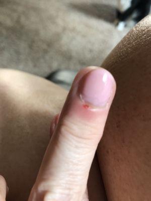 A cut cuticle.