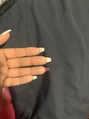 Crooked nails