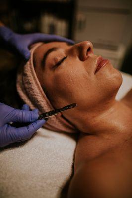 Dermaplane Facial