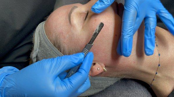 Dermaplaning Facial