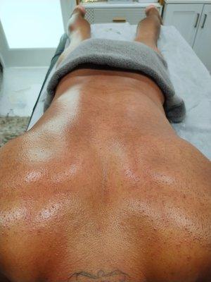 Men's Back Wax (After)