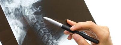 New York Spine and Sports Surgery: Aron D. Rovner, MD | Saddlebrook, NJ