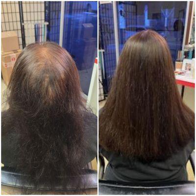 Before & After
MicroLines Hair Topper
solution for thinning hair, alopecia etc.